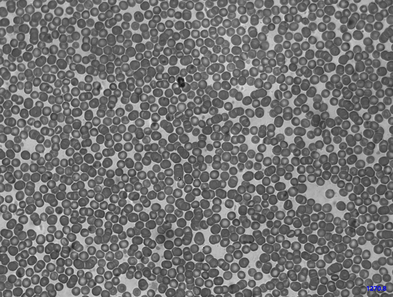 MTR3CCD應(yīng)用實(shí)例 MTR3CCD應(yīng)用實(shí)例